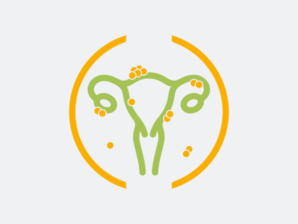 Grafische Darstellung Gebärmutter und Eierstöcke, Endometriosezentrum