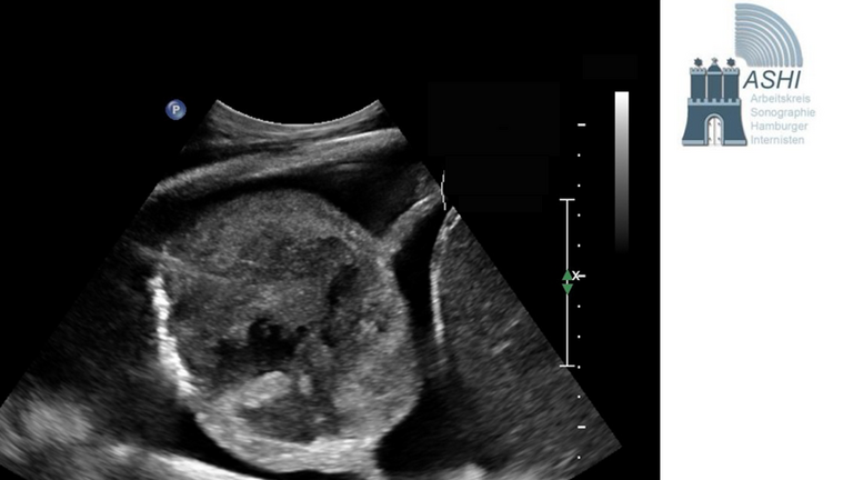 Abbildung einer Sonographie zum Sonographischen Kolloquium in Hamburg