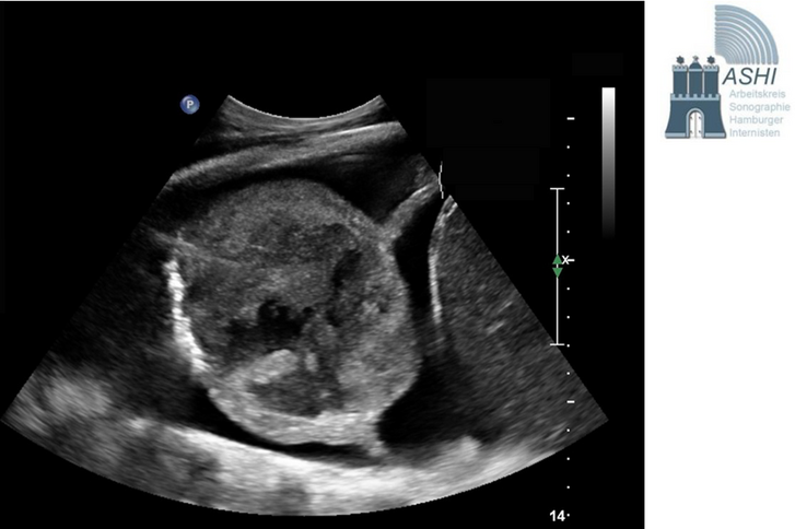 Abbildung einer Sonographie zum Sonographischen Kolloquium in Hamburg